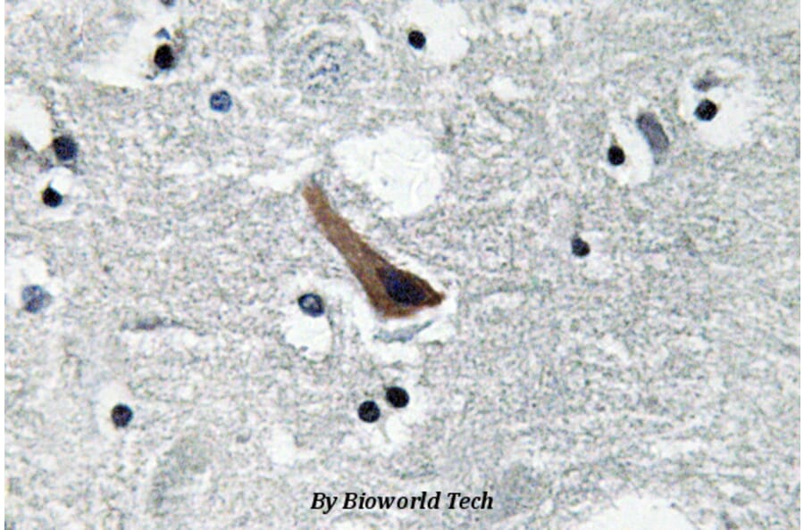 Anti-GABAA Rα1 (L361) Antibody from Bioworld Technology (BS3563) - Antibodies.com