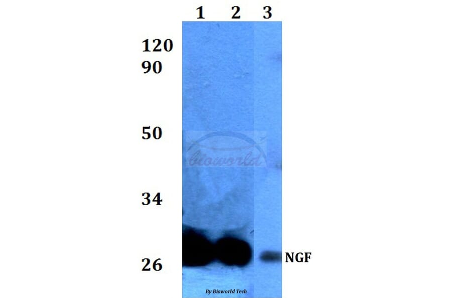 Anti-Pro-NGF (L82) Antibody from Bioworld Technology (BS3564) - Antibodies.com
