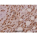 Anti-Pro-NGF (L82) Antibody from Bioworld Technology (BS3564) - Antibodies.com