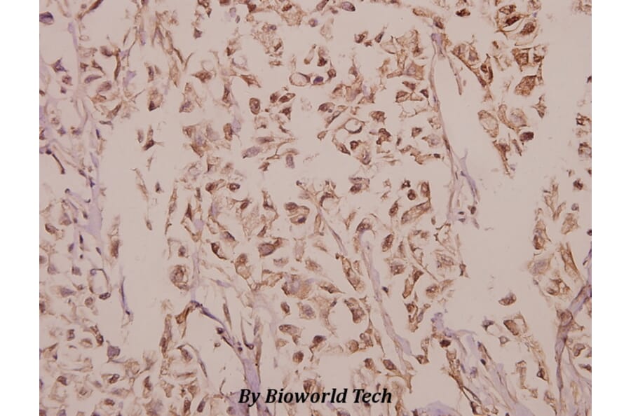 Anti-p38 (T175) Antibody from Bioworld Technology (BS3567) - Antibodies.com