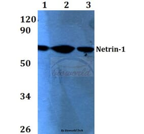 Anti-Netrin-1 (Q533) Antibody from Bioworld Technology (BS3569) - Antibodies.com
