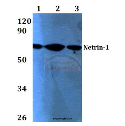 Anti-Netrin-1 (Q533) Antibody from Bioworld Technology (BS3569) - Antibodies.com