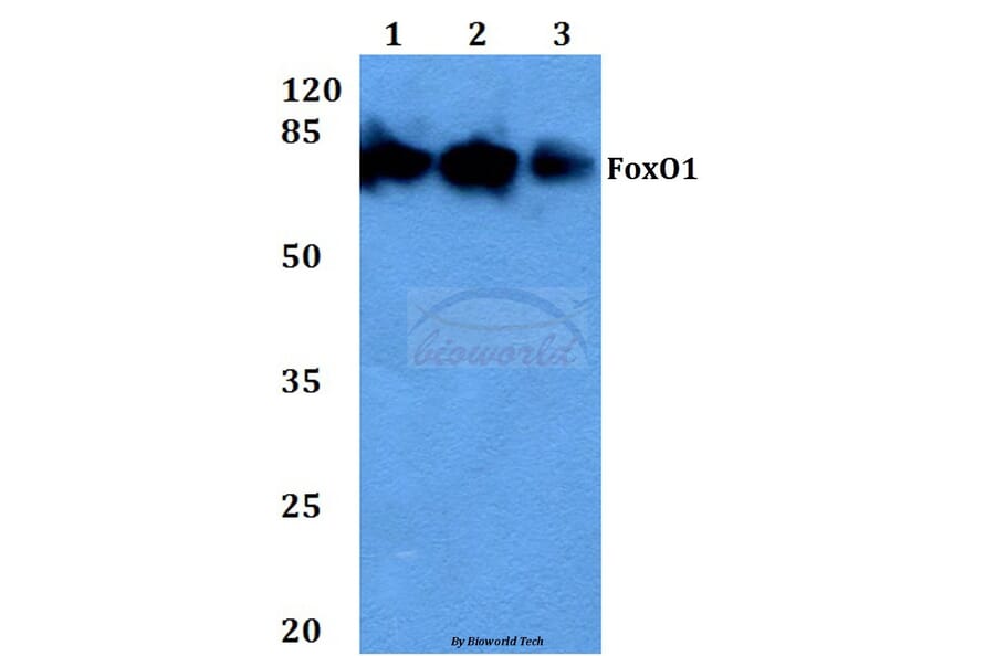 Anti-FKHR/FoxO1 (F313) Antibody from Bioworld Technology (BS3573) - Antibodies.com