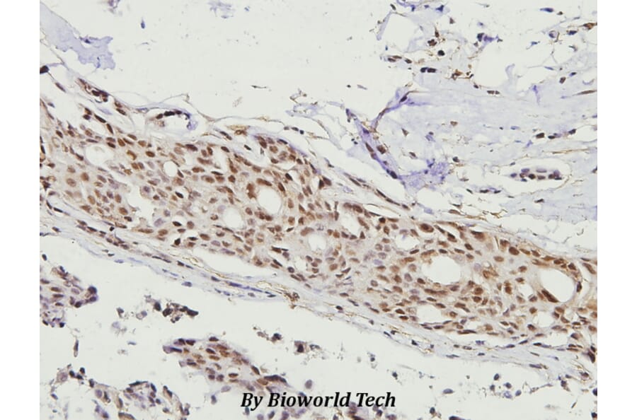 Anti-FKHR/FoxO1 (F313) Antibody from Bioworld Technology (BS3573) - Antibodies.com