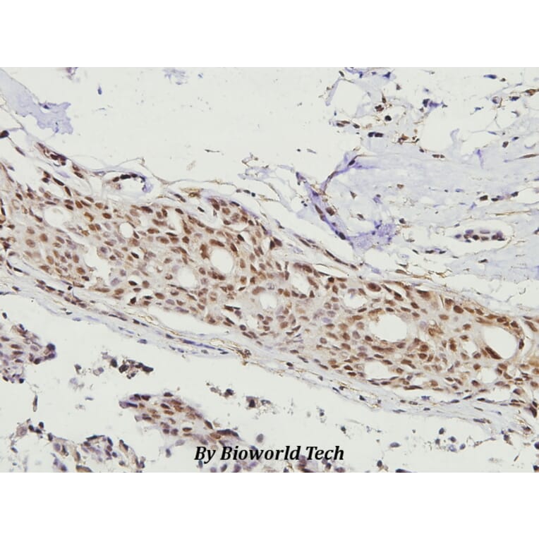 Anti-FKHR/FoxO1 (F313) Antibody from Bioworld Technology (BS3573) - Antibodies.com