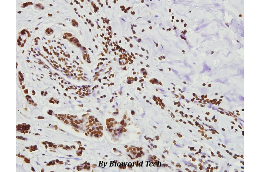 Anti-FoxO3A (P247) Antibody from Bioworld Technology (BS3574) - Antibodies.com