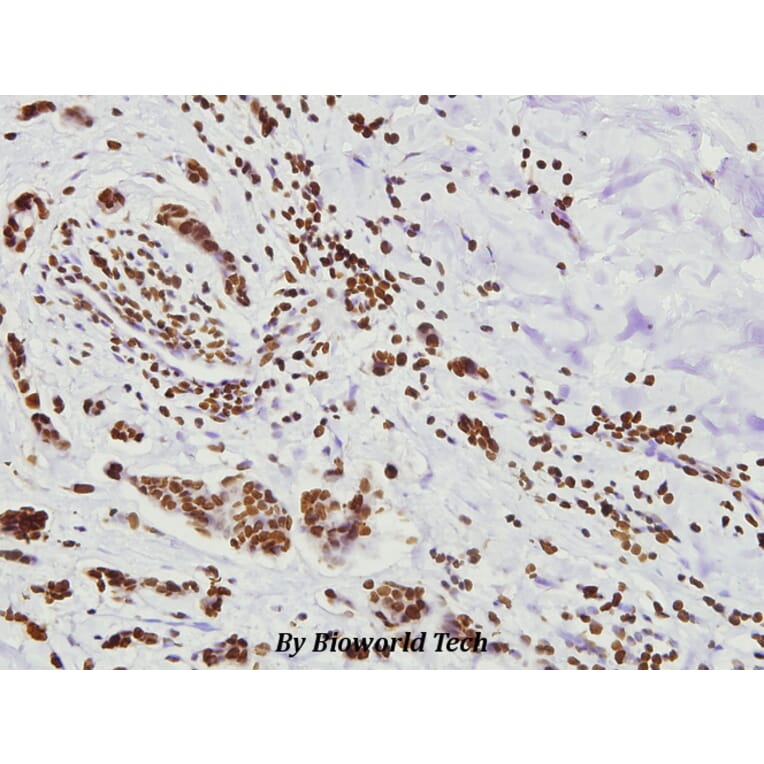 Anti-FoxO3A (P247) Antibody from Bioworld Technology (BS3574) - Antibodies.com