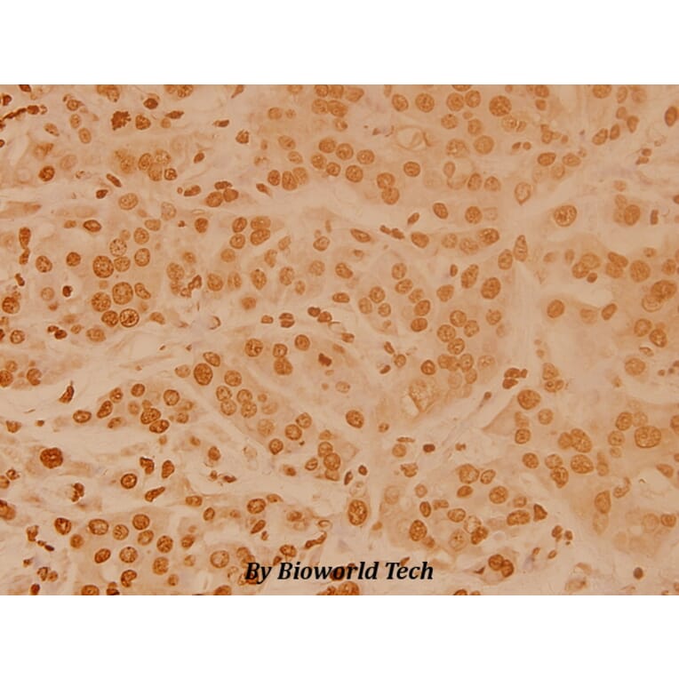 Anti-FoxO4 (P191) Antibody from Bioworld Technology (BS3575) - Antibodies.com