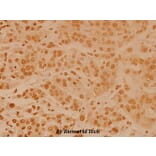 Anti-FoxO4 (P191) Antibody from Bioworld Technology (BS3575) - Antibodies.com