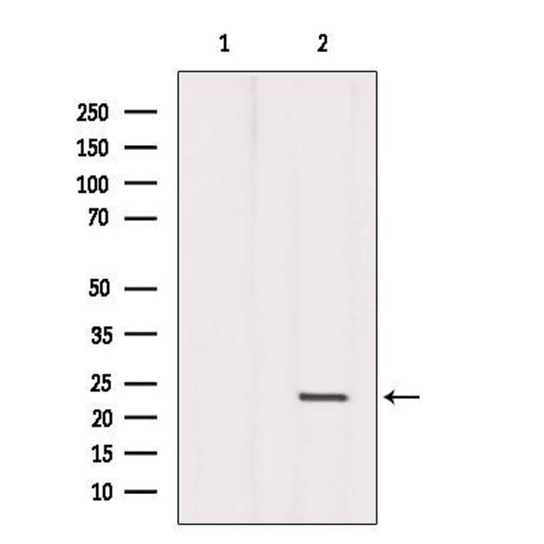 Rabbit polyclonal antibody to Dermatopontin. (A260811)