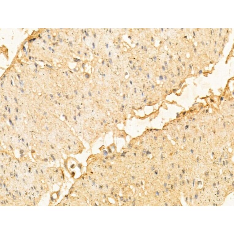 Lapin polyclonal antibody to Dermatopontin. (A260811) | Antibodies.com