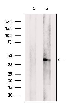 Rabbit polyclonal antibody to TACO1. (A261377) | Antibodies.com