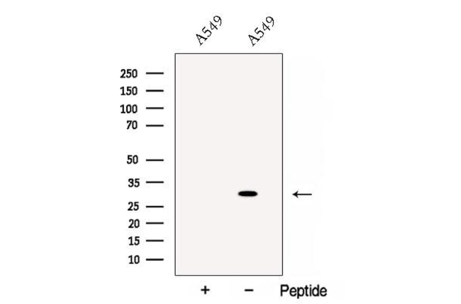Validation Data - Anti-Cathepsin L Antibody (A261494)