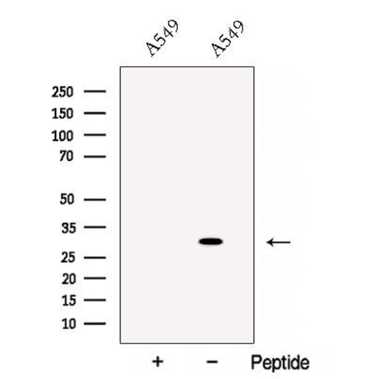 Validation Data - Anti-Cathepsin L Antibody (A261494)