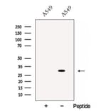 Validation Data - Anti-Cathepsin L Antibody (A261494)