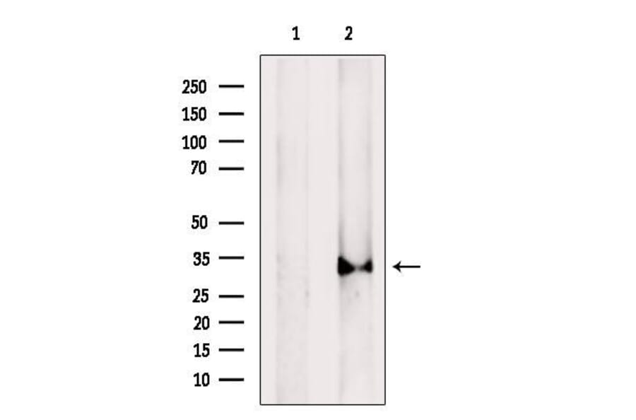 Validation Data - Anti-Cathepsin L Antibody (A261494)