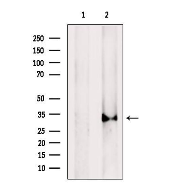 Validation Data - Anti-Cathepsin L Antibody (A261494)