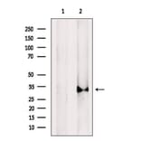 Validation Data - Anti-Cathepsin L Antibody (A261494)