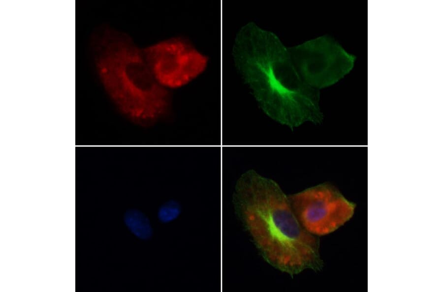 Validation Data - Anti-Cathepsin L Antibody (A261494)