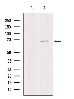 Rabbit polyclonal antibody to Collagen X. (A261827) | Antibodies.com