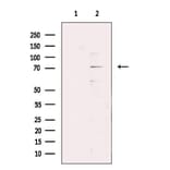 Validation Data - Anti-ADAMTS5 Antibody (A261881)