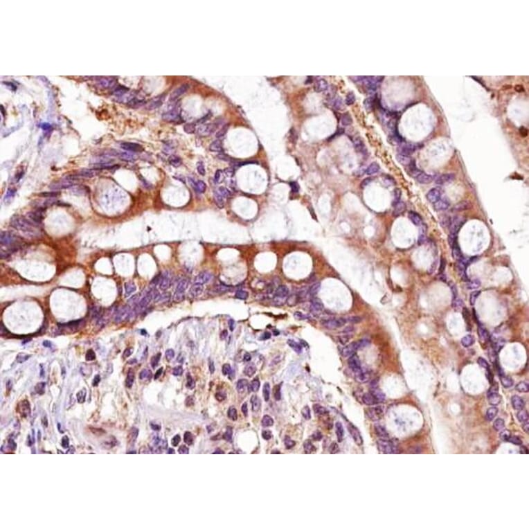 Validation Data - Anti-ADAMTS5 Antibody (A261881)