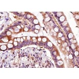 Validation Data - Anti-ADAMTS5 Antibody (A261881)