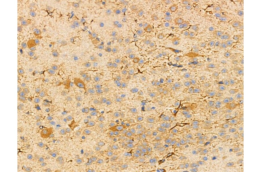 Rabbit polyclonal antibody to 5HT2B Receptor. (A264279)