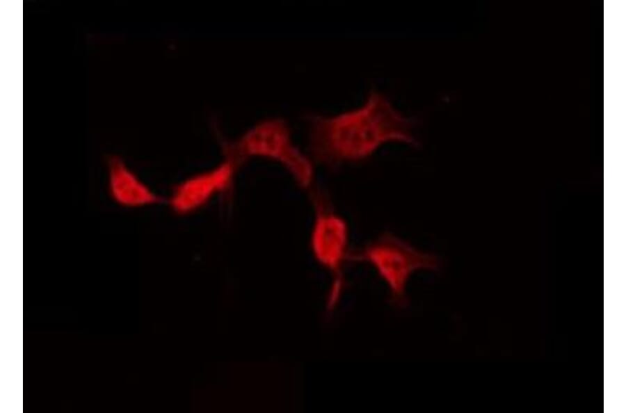 Validation Data - Anti-A26B1 Antibody (A265113)