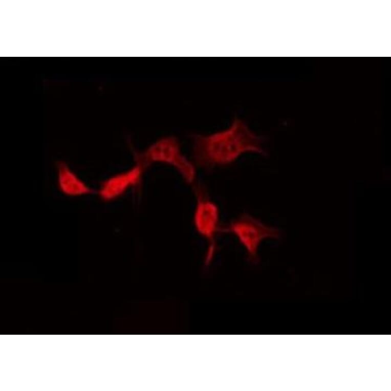 Validation Data - Anti-A26B1 Antibody (A265113)