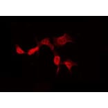 Validation Data - Anti-A26B1 Antibody (A265113)