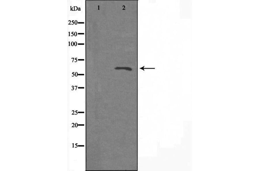 Validation Data - Anti-A26B1 Antibody (A265113)