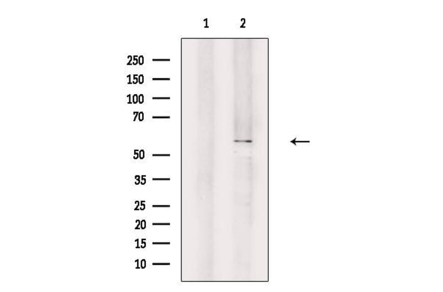 Validation Data - Anti-A26B1 Antibody (A265113)
