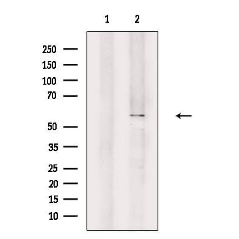 Validation Data - Anti-A26B1 Antibody (A265113)