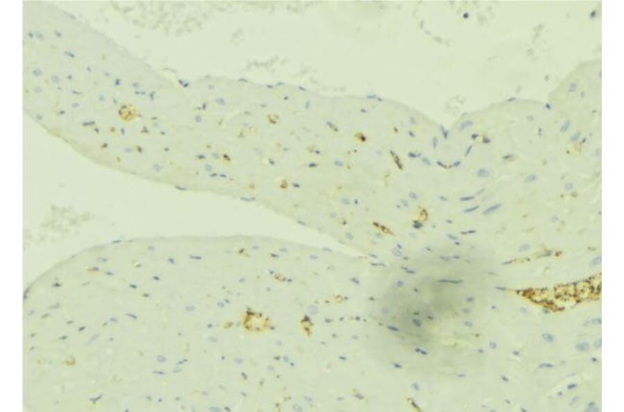 Validation Data - Anti-SLC27A2 Antibody (A266202)