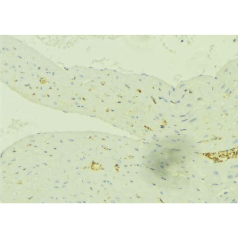 Validation Data - Anti-SLC27A2 Antibody (A266202)