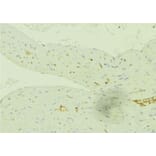 Validation Data - Anti-SLC27A2 Antibody (A266202)