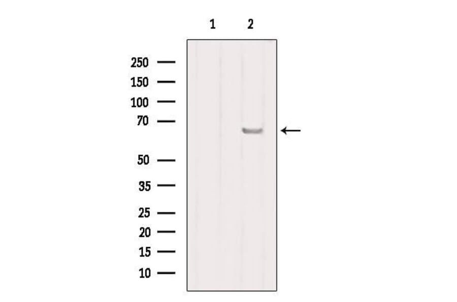 Validation Data - Anti-SLC27A2 Antibody (A266202)