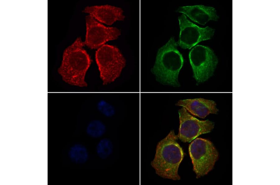 Validation Data - Anti-SLC27A2 Antibody (A266202)