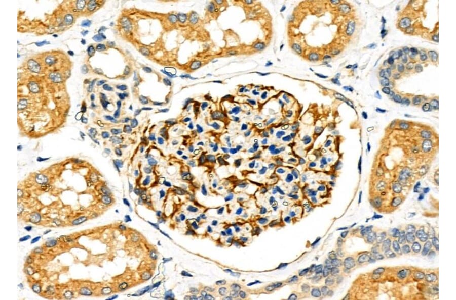 Validation Data - Anti-SLC27A2 Antibody (A266202)