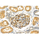 Validation Data - Anti-SLC27A2 Antibody (A266202)