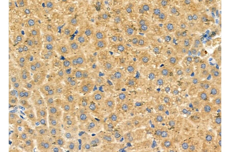 Validation Data - Anti-SLC27A2 Antibody (A266202)