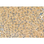 Validation Data - Anti-SLC27A2 Antibody (A266202)