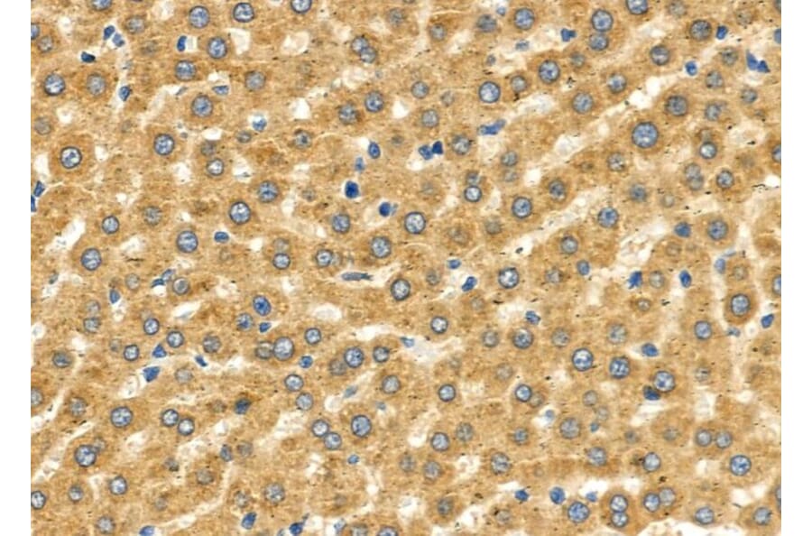Validation Data - Anti-SLC27A2 Antibody (A266202)