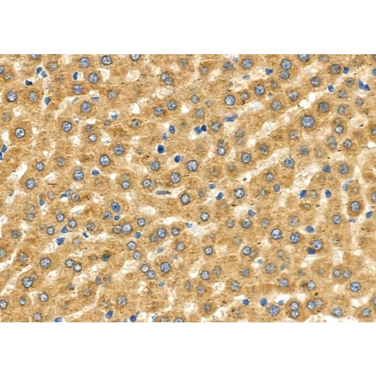 Validation Data - Anti-SLC27A2 Antibody (A266202)