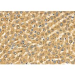 Validation Data - Anti-SLC27A2 Antibody (A266202)