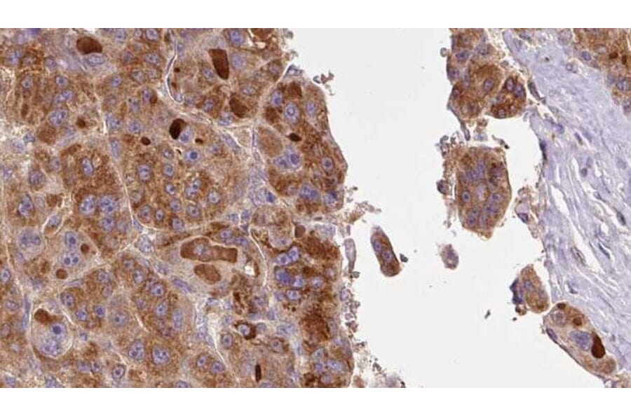 Validation Data - Anti-SLC16A1 Antibody (A267112)