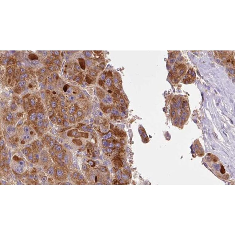 Validation Data - Anti-SLC16A1 Antibody (A267112)