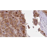 Validation Data - Anti-SLC16A1 Antibody (A267112)