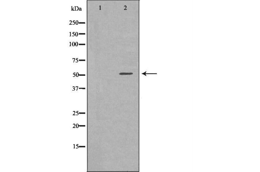 Validation Data - Anti-SLC16A1 Antibody (A267112)